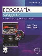 Ecografía vascular : cómo, por qué y cuándo