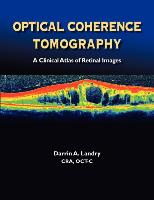 Optical Coherence Tomography a Clinical Atlas of Retinal Images