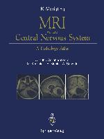 MRI of the Central Nervous System