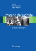 Imaging del rachide