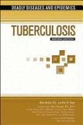 Tuberculosis