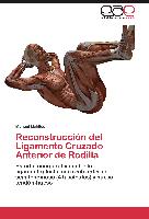 Reconstrucción del Ligamento Cruzado Anterior de Rodilla