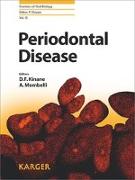 Periodontal Disease