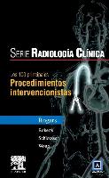 Serie Pocket de Radiologia: Los 100 Diagnosticos Principales En Procedimientos Intervencionistas