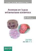 Avances en lupus eritematoso sistémico