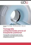 Tomografía computarizada previa al trasplante pulmonar