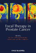 Focal Therapy in Prostate Cancer