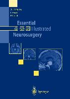 Essential Illustrated Neurosurgery