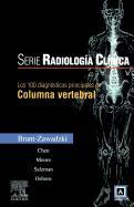 Los 100 Diagnosticos Principales En Columna Vertebral