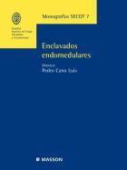 Secot 7 Monograf: Enclavados Endomedulares