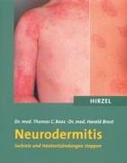 Neurodermitis