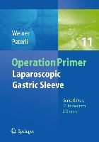 Laparoscopic Gastric Sleeve