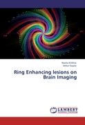 Ring Enhancing lesions on Brain Imaging