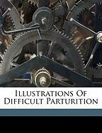 Illustrations Of Difficult Parturition