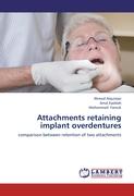 Attachments retaining implant overdentures