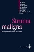 Struma maligna