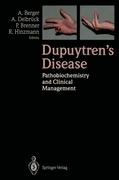 Dupuytren¿s Disease