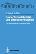 Kronenfortsatzbrüche und Ellenbogenstabilität