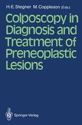 Colposcopy in Diagnosis and Treatment of Preneoplastic Lesions