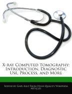X-Ray Computed Tomography: Introduction, Diagnostic Use, Process, and More