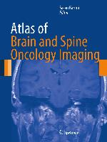 Atlas of Brain and Spine Oncology Imaging