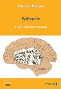 Epilepsie: Protokoll einer Heilung