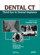 Dental CT Third Eye in Dental Implants