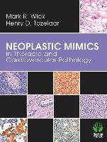 Neoplastic Mimics in Thoracic and Cardiovascular Pathology