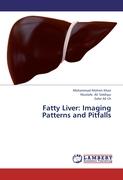 Fatty Liver: Imaging Patterns and Pitfalls