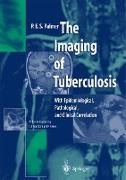 The Imaging of Tuberculosis
