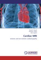 Cardiac MRI