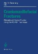 Craniomaxillofacial Fractures