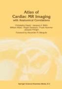 Atlas of Cardiac MR Imaging with Anatomical Correlations