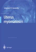 Uterus myomatosus