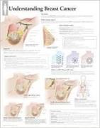 Understanding Breast Cancer Laminated Poster