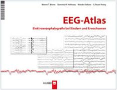 EEG–Atlas