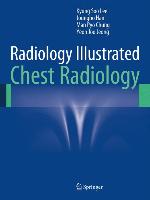 Radiology Illustrated: Chest Radiology