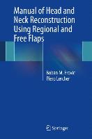 Handbook of Head and Neck Reconstruction Using Regional and Free Flaps