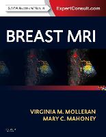 Breast MRI