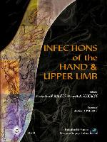 Infections of the Hand & Upper Limb