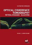 Optical Coherence Tomography Retinal Diseases-Glucoma