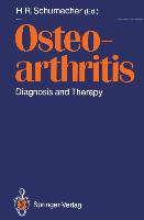 Osteoarthritis