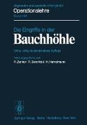 Die Eingriffe in der Bauchhöhle