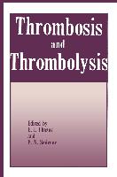 Thrombosis and Thrombolysis