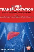 Liver Transplantation