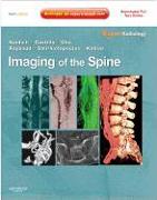 Imaging of the Spine [With Access Code]