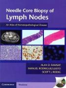 Needle Core Biopsy of Lymph Nodes with DVD-ROM
