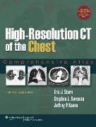 High-Resolution CT of the Chest: Comprehensive Atlas