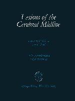 Lesions of the Cerebral Midline