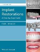 Implant Restorations: A Step-By-Step Guide